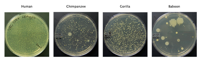 Skin microbes from the armpits of a human subject and a chimpanzee, a gorilla, and a baboon from the North Carolina Zoo.