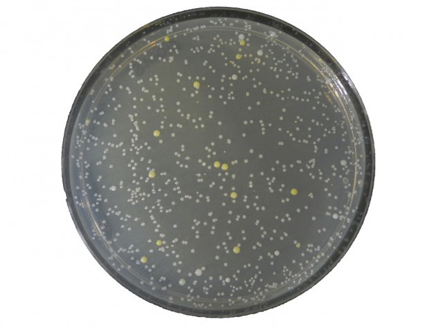 Cultured bacteria from one of the samples in the study. Photo credit: Dawn Stancil, North Carolina Central University.
