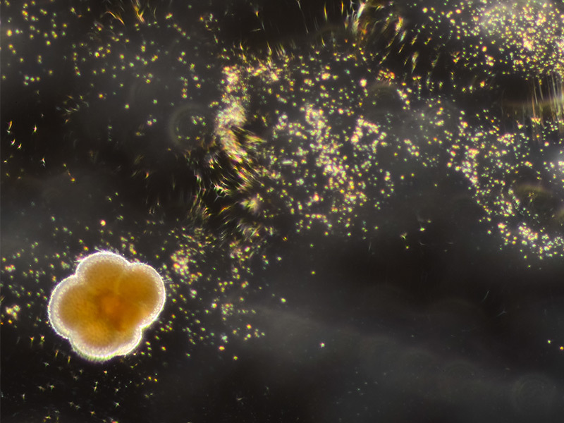 Live foraminifera.