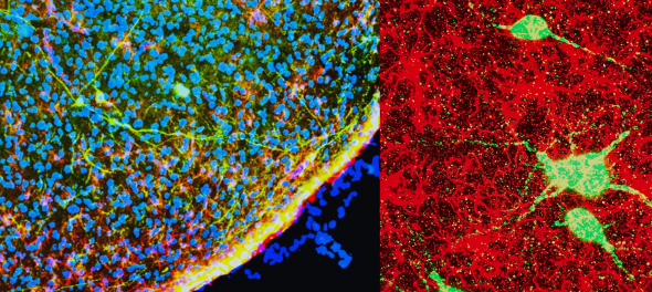 magnified images of neurons and immune system cells with different colors representing different cellular structures